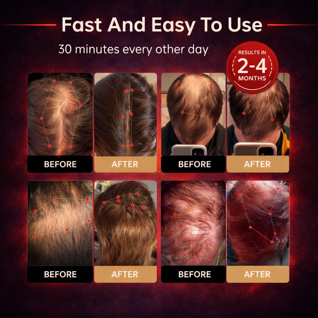 PURE™ - Red Light Therapy Regrowth Cap
