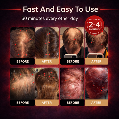 PURE™ - Red Light Therapy Regrowth Cap